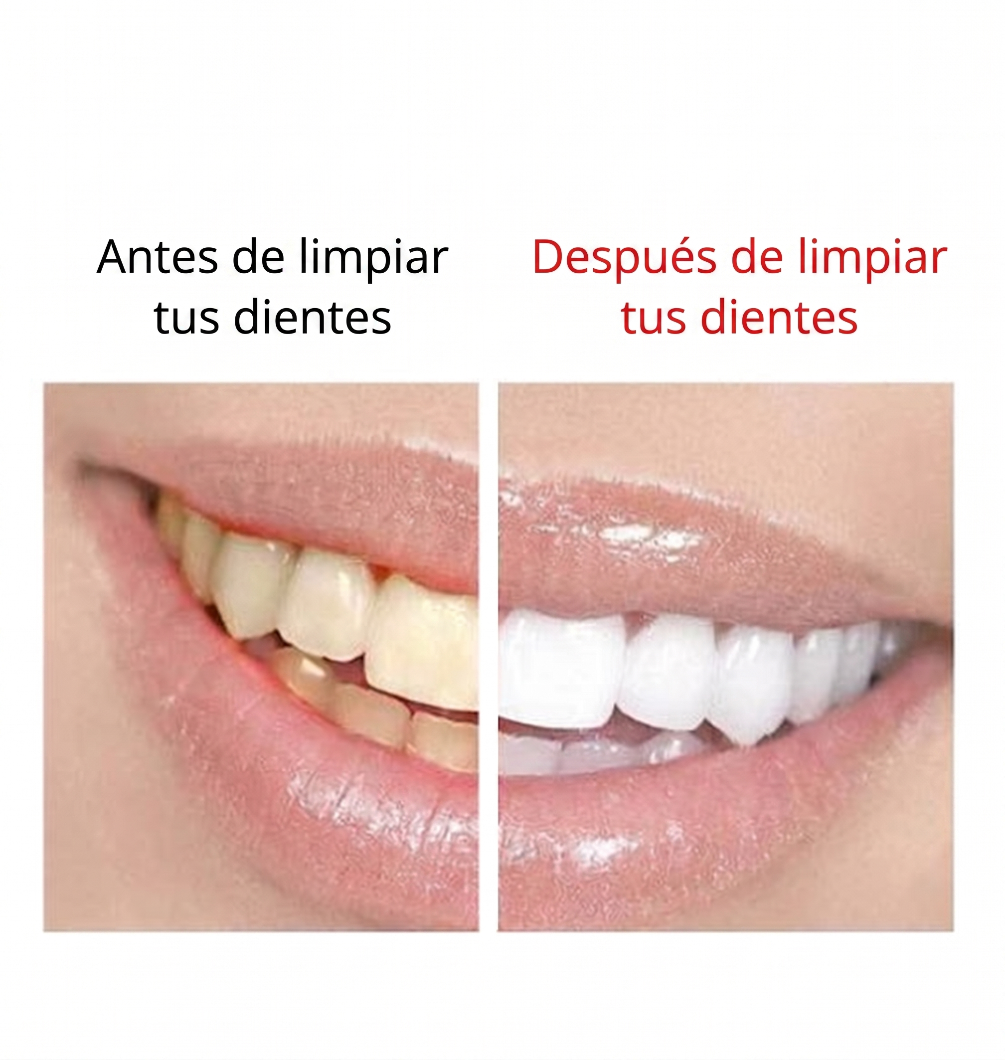 Removedor de Sarro Dental Ultrasónico Professional