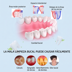 Removedor de Sarro Dental Ultrasónico Professional